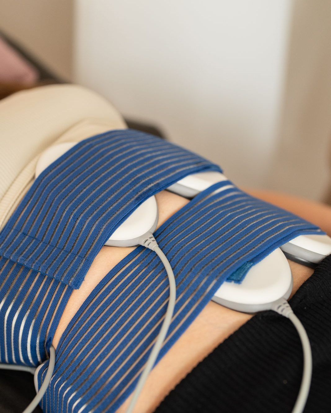 Behandlungspads auf dem Bauch beim Bodyforming